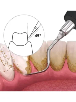 DEPLAQUED Schall-Zahnreiniger in schwarz