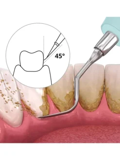 DEPLAQUED Schall-Zahnreiniger in türkis