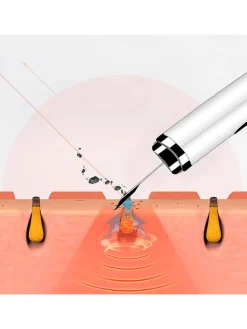 Hochfrequenz-Gesichtsmassagegerät in Weiß