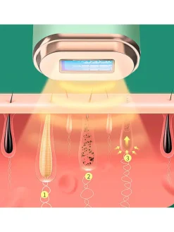 IPL-Haarentferner in Grün